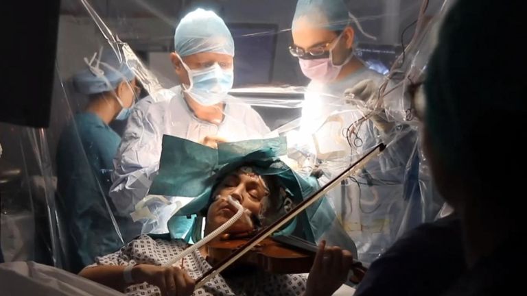 إيقاظ مريضة أثناء جراحة في الدماغ لتعزف على #الكمان
bit.ly/326PufY