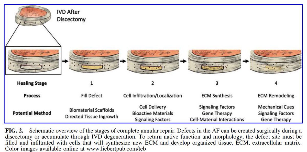 #ivdhealing

Biologic Annulus Fibrosus Repair: A Review of Preclinical In Vivo Investigations

ncbi.nlm.nih.gov/pubmed/29105592