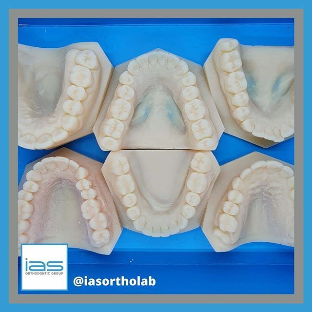 Preparing some printed models ready to be shown to patients 👌 
#printedmodels #3D #3dprinting #3dprintedmodels #archwize #teeth #patient #dentistry ift.tt/2uY8X6v
