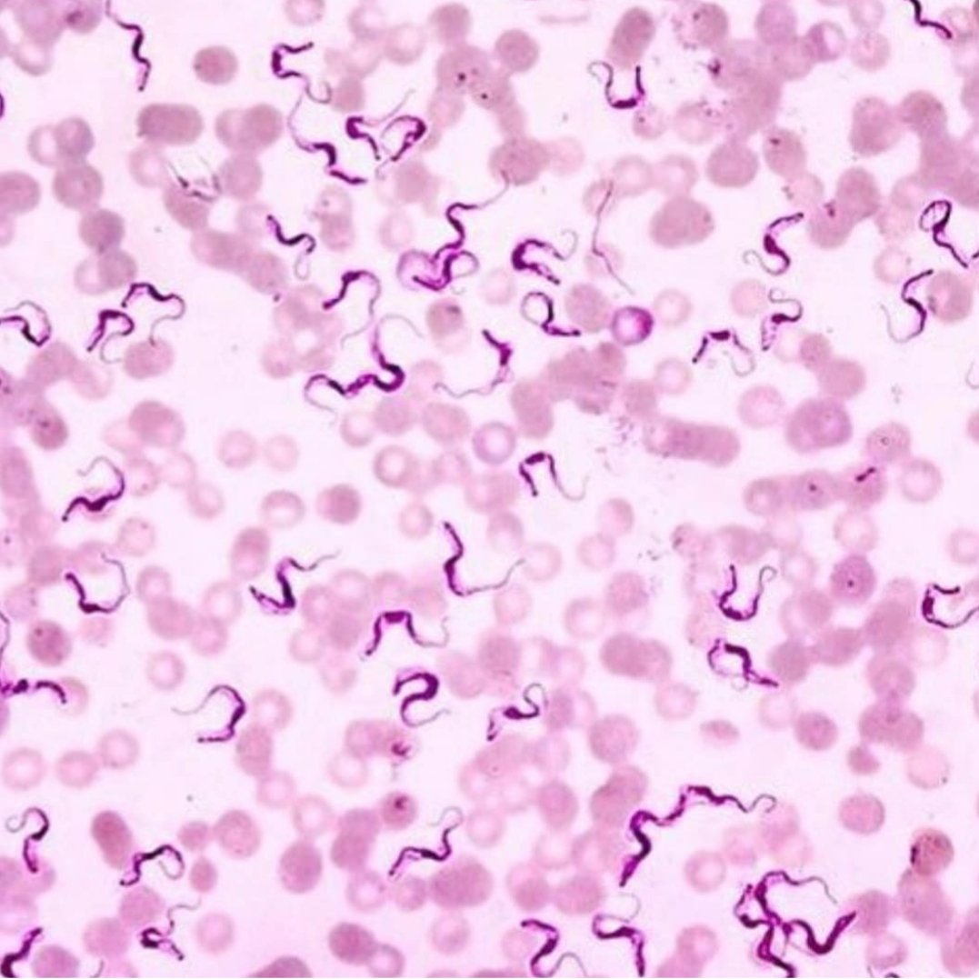 trypanosoma cruzi formas
