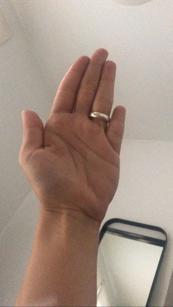 milagrosgr's tweet photo. @CesareMarty @LenceMarti ¡No están solos! a una amiga le falta una falange y una cuenta de Twitter. Dice que también solo se burlan. https://t.co/GP6qQmmfy7