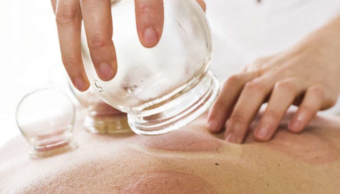 #CuppingTherapy is a simple process of treating various #health issues using different kinds of cups. However, not everyone can perform this treatment as advanced treatments require specialized training.. Great Article on #Cupping Therapy Safety: buff.ly/2KjQWGD