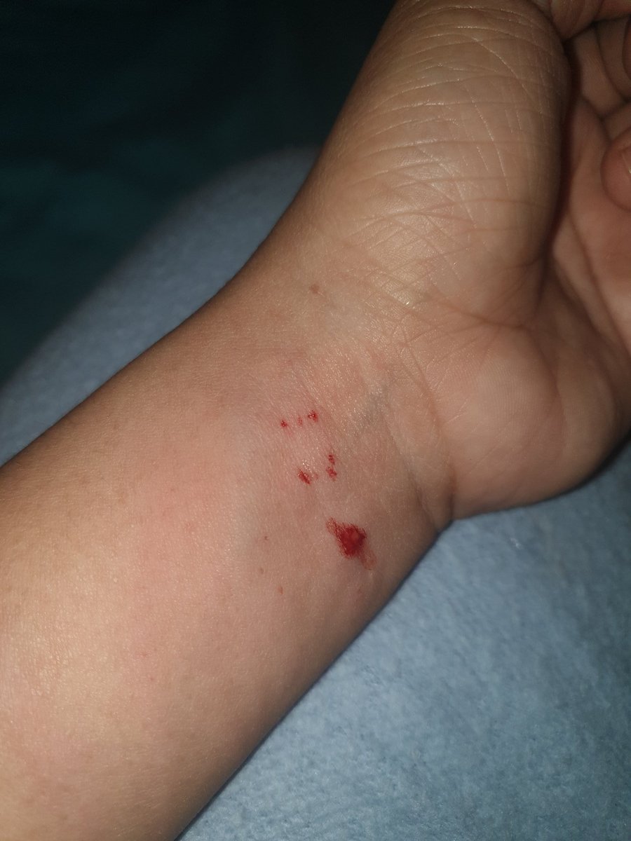 pakig's tweet photo. ...that moment when you are carried away with your emotion... you recourse into hurting yourself just not to feel the pain inside. 

Thanks God, i only saw a comb. 😭  

I'm sorry Lord. 😭🥺😭 Please forgive me. https://t.co/zNA9SEOThA