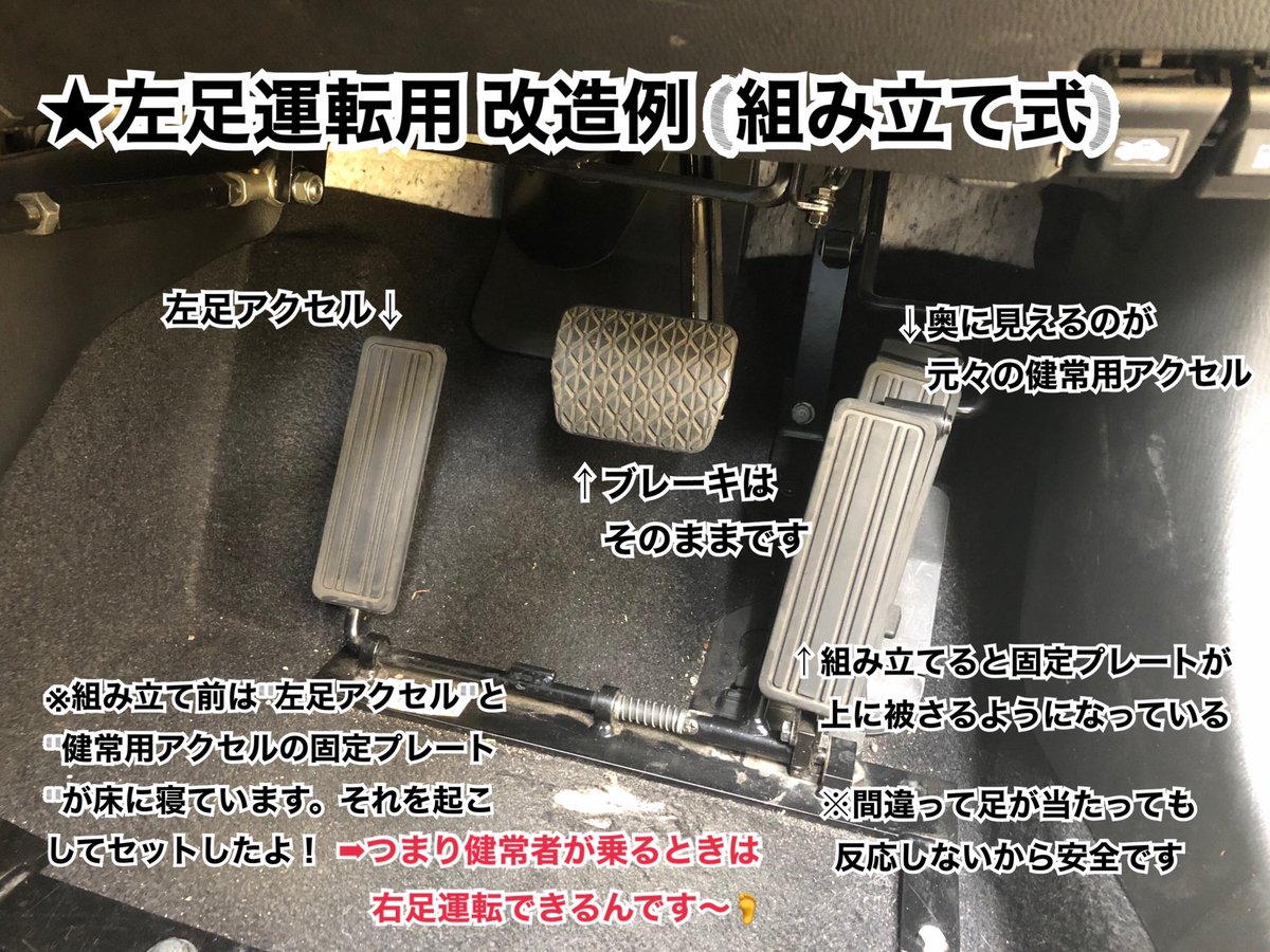 みかん 右大腿義足 本日もリハ完了 左アクセル運転の１日教習やったよ 右切断だから私もう普通の車乗れないんだ 教習ある病院はレアだって ペダル逆だからブレーキ右右右 って念じて乗った 最初は踏み加減分からず急ブレーキがっくん 徐々に慣れ