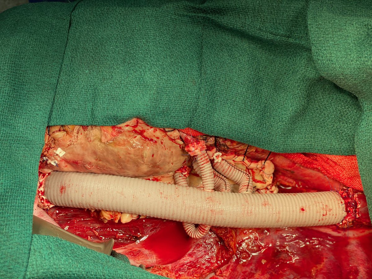 Kim de la Cruz, MD MPH(c) FACS FACC FCCP tweet media