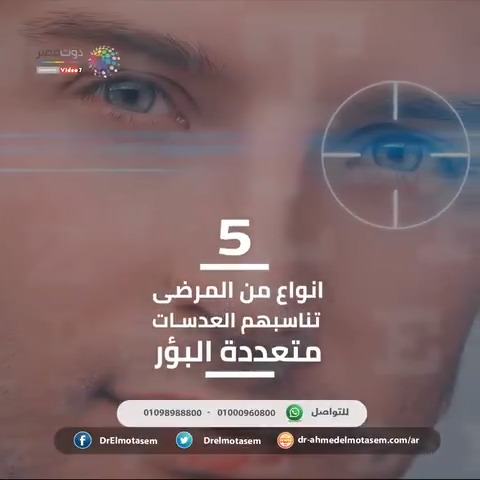 مميزات وعيوب العدسات متعددة البؤر لعلاج المياه البيضاء .. الدكتور أحمد المعتصم يوضحhttp://www.youm7.com/4638221 #الدكتور_أحمد_المعتصم
