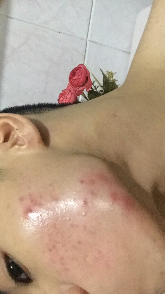 jzdar_18's tweet photo. Rt for good skin condition https://t.co/yW0X7kk3ZB