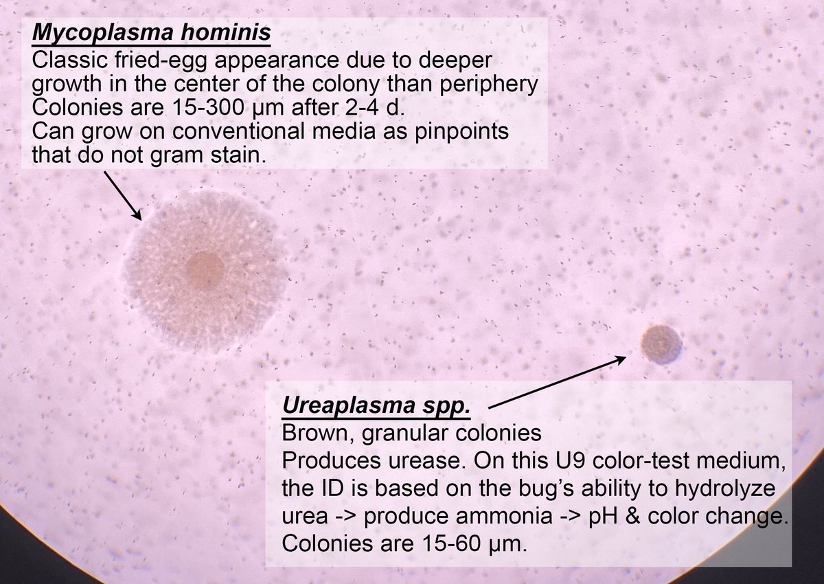 Микоплазмы строение микробиология. Микоплазма опасна ли. Возбудитель микоплазмоза mycoplasma pneumoniae. Микоплазма опасна ли. Микоплазма пневмония микроскопия.