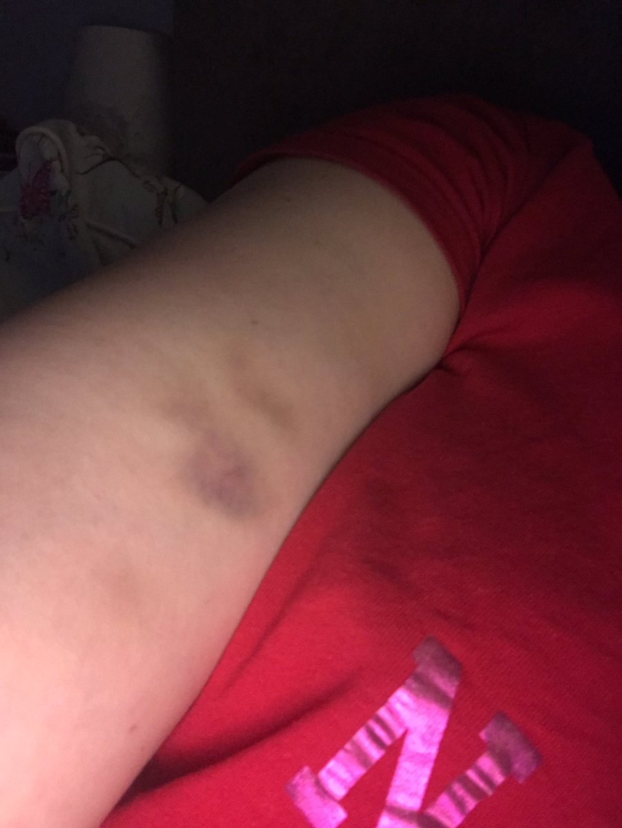 I’ve had the best time travelling around the entire group delivering the launchpads but I think I should have requested danger money Stew! #lookatmybruises #hardwork #nextgenlaunchpads #u6success So great to see all the branches and meet/see all you lovely people 😍