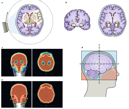 NatRevClinOncol's tweet photo. New Review by @DrJohnSuh,
@Rrkotecha,
@SamuelChaoMD,
@BrainTumorDoc and colleagues now live online: 'Current approaches to the management of brain metastases' https://t.co/53E3ZsE1UC #camets https://t.co/XIAuB5ranZ
