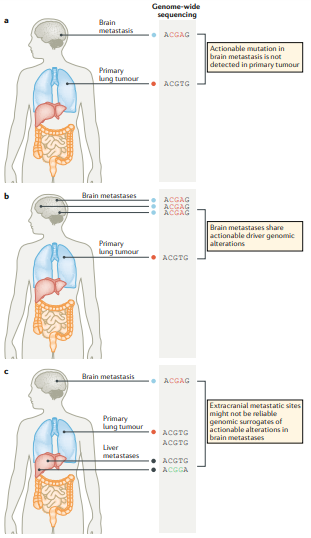 NatRevClinOncol's tweet photo. New Review by @DrJohnSuh,
@Rrkotecha,
@SamuelChaoMD,
@BrainTumorDoc and colleagues now live online: 'Current approaches to the management of brain metastases' https://t.co/53E3ZsE1UC #camets https://t.co/XIAuB5ranZ