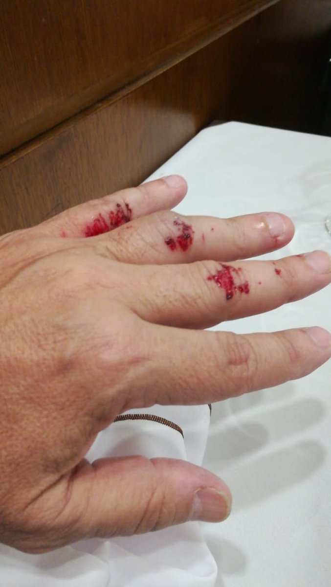 Pido disculpas a los dos motochorros por no haber dejado que me robaran la mochila a las 12 del mediodía en Cabrera y Mario Bravo y romperle de una trompada el visor y haberles tirado la moto y haberlos golpeado para defenderme del asalto, esperando que superen el trauma