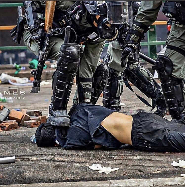 gfhkstkm_721831's tweet photo. This is what the HKpolice did for the people who want to fight for the freedom.
#StandwithHK #SOSHK #FreeHK #HongKongProtest #5demands #not1less #科勞手足 #手足互科 #互科手足 #光復香港 #時代革命 #五大訴求 #缺一不可 https://t.co/Bj43Q46DPL