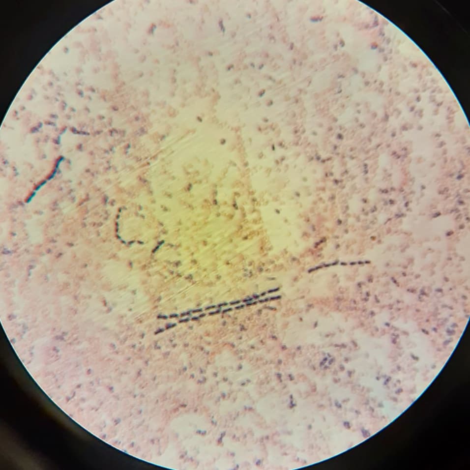 Astroeco_Morgan's tweet photo. #SoilEcology Examining morphological characteristics of #bacteria and #fungi using #gramstaining techniques (gram positive bacteria appear purple, gram negative bacteria appear pinkish)
(4/5)
#CornellSCS https://t.co/Rl0OeyQWng