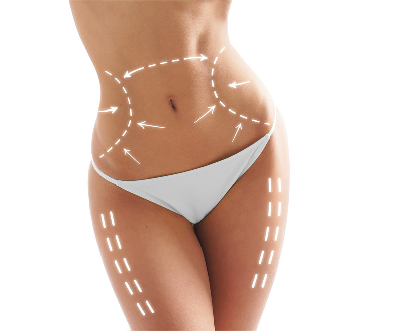 FDTysonsCorner's tweet photo. Get a sleeker, more youthful figure today with Tumescent Technique Liposuction. The procedure is safe. Recovery is easy. And Dr. Steven Rotter can perform it on any unwanted fat. Call (703) 544-7585 for a consultation. https://t.co/Lp6yXv66IO