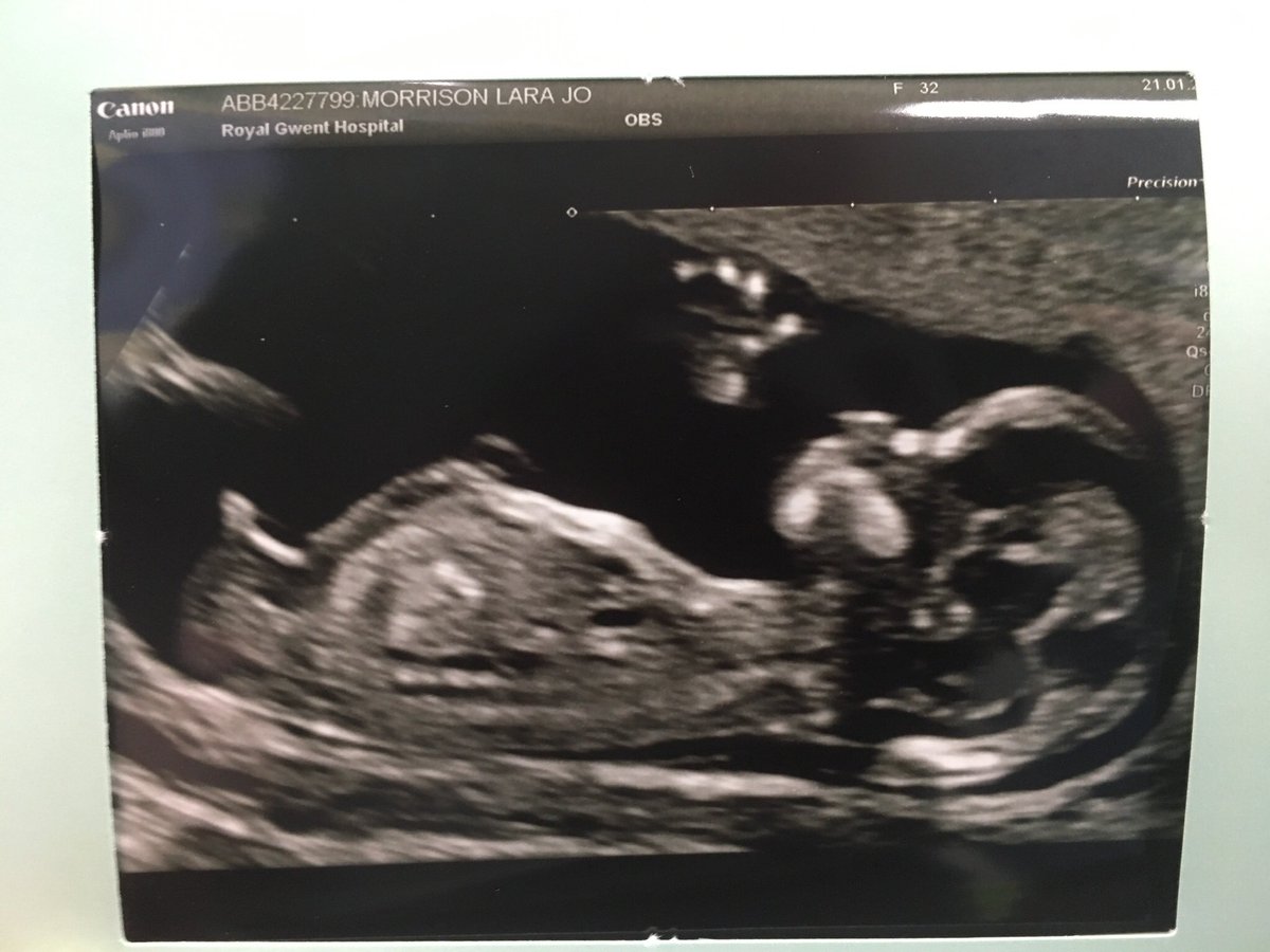 brad morrison tweet media