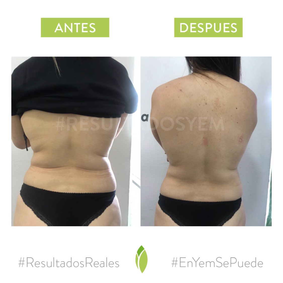 #ResultadosRealesYem
