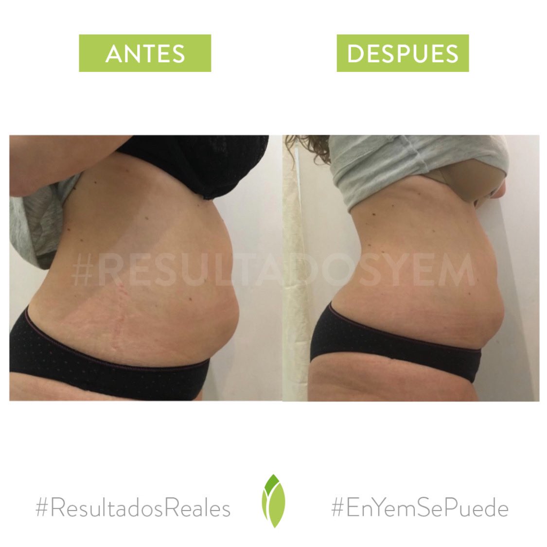 Clinical YEM tweet media