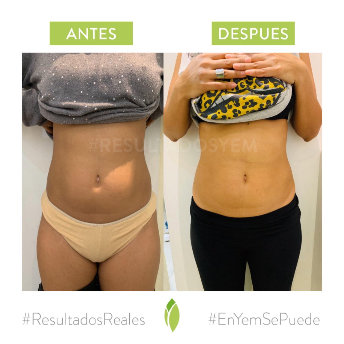 Clinical YEM tweet media