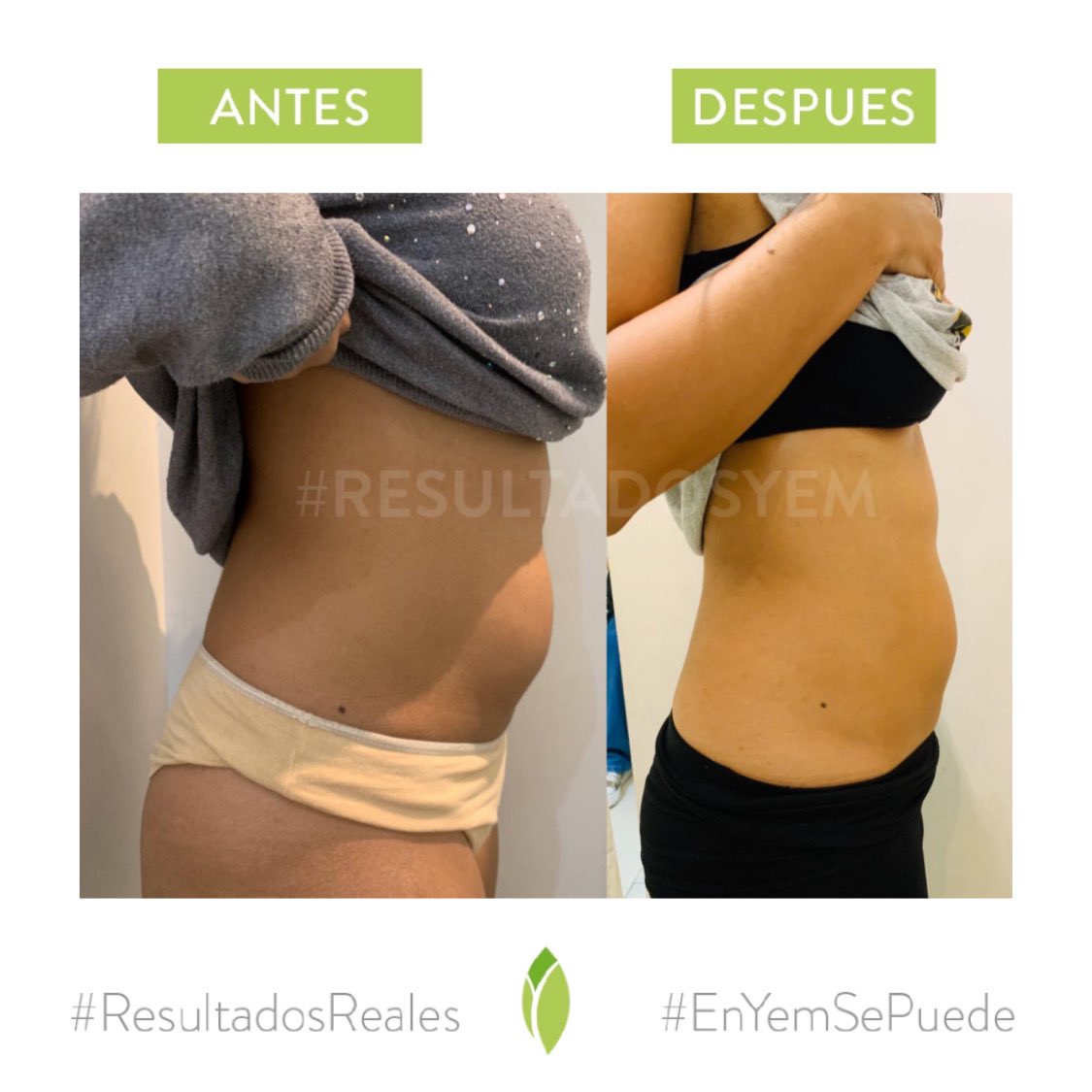 Clinical YEM tweet media