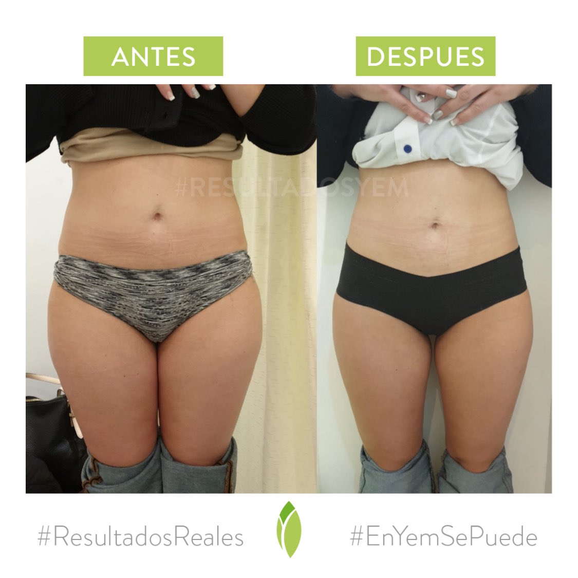 Clinical YEM tweet media