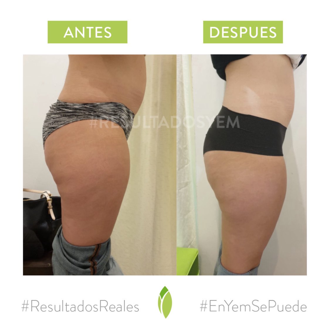 Clinical YEM tweet media