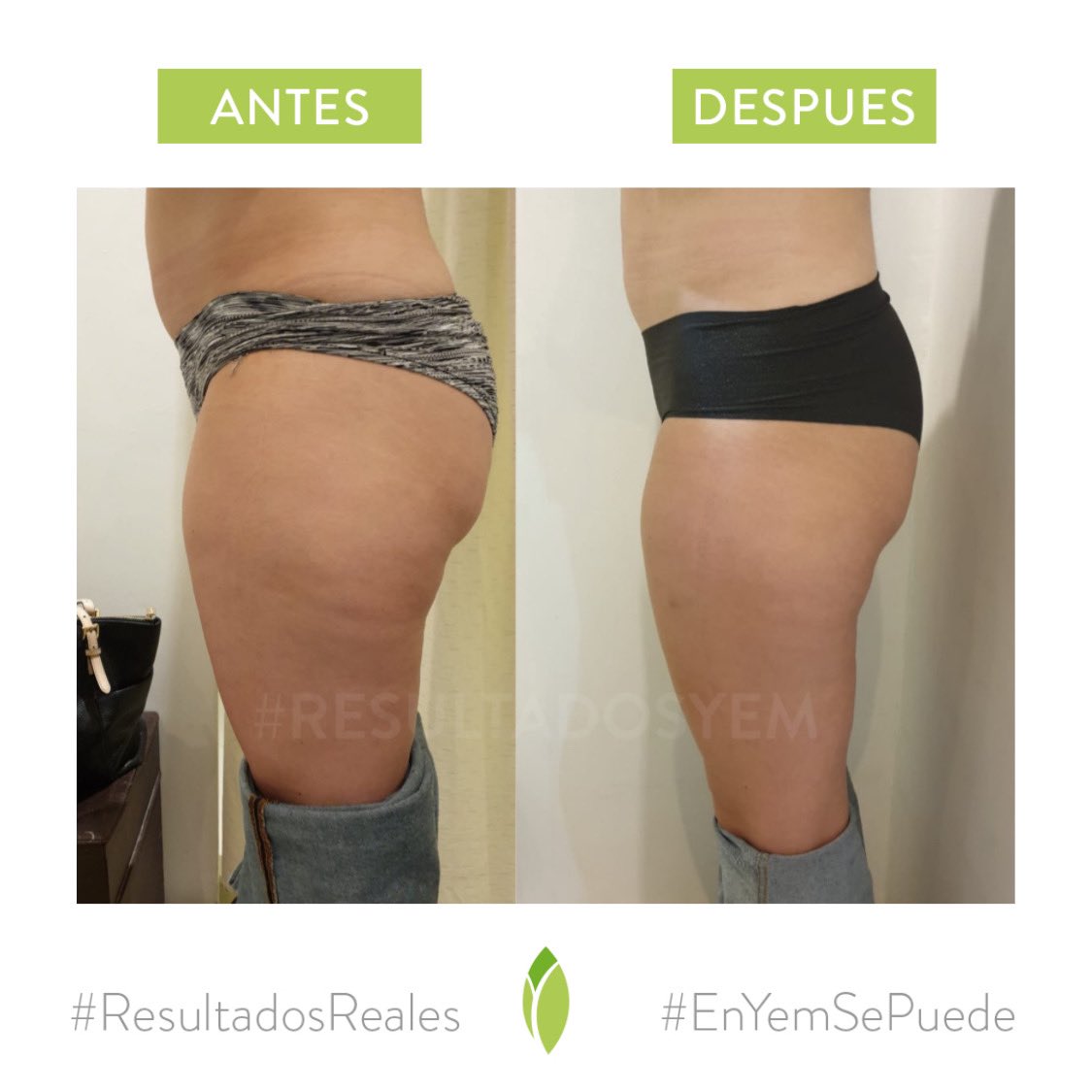 Clinical YEM tweet media