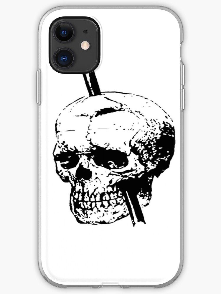 TaicheTees's tweet photo. #InjuryATWork #Skull of #PhineasGage With #TampingIron by taiche | Redbubble #iPhoneCases & #iPhoneCovers by taiche | Redbubble Try #SnapCases for a #lightweighthardcase or #ToughCases for an #extradurablecase option #ATSocialMedia @redbubble https://t.co/3zqYlc9rls https://t.co/AmUOHTxYxk