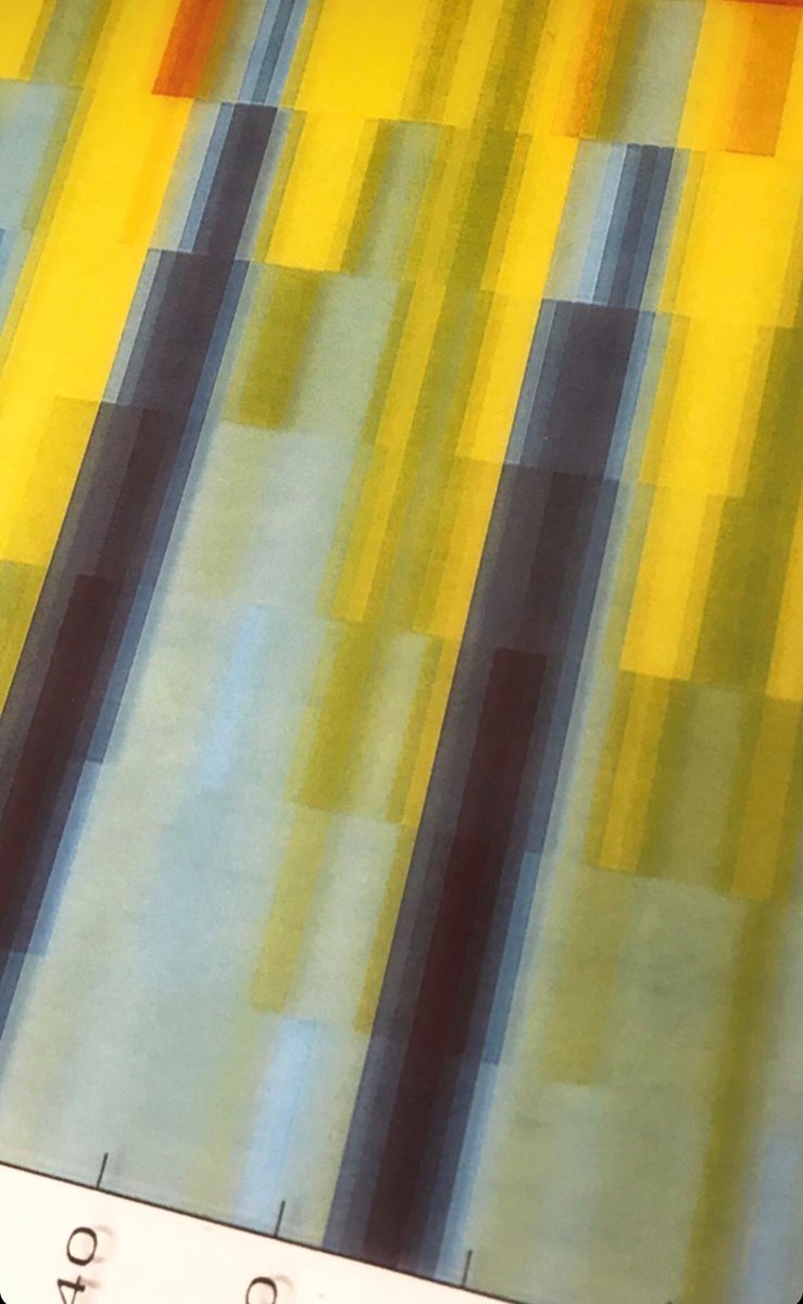 UCL News (@uclnews) on Twitter photo Art co-produced by neuroscientists & artists, exploring labels associated with mental health, is going on show starting today in east London. The <a href="/dearworldproj/">dearworldproject</a> events with @WCHN_UCL <a href="/UCLIoN/">UCL Queen Square Institute of Neurology</a> also include comedy & a discussion of mental health in pro sports ucl.ac.uk/news/2020/feb/… Art co-produced by neuroscientists & artists, exploring labels associated with mental health, is going on show starting today in east London. The <a href="/dearworldproj/">dearworldproject</a> events with @WCHN_UCL <a href="/UCLIoN/">UCL Queen Square Institute of Neurology</a> also include comedy & a discussion of mental health in pro sports ucl.ac.uk/news/2020/feb/…