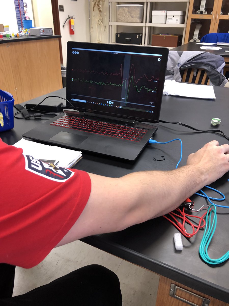 NickJHobbs's tweet photo. Fun with the nervous system on this #PhysioFriday! We measured conduction velocity of action potentials in earthworms and effect of different solution on synaptic activity in crickets using SpikerBoxes from @BackyardBrains. @cas_unk #WeAreArtsandScience https://t.co/Rp83TBz0mz