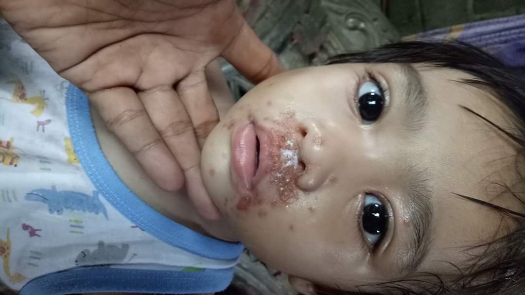 Twitter please do your magic

Cepat sembuh ya adek kecil..
Biar bisa bermain lagi..
Mohon doa nya yaa buat Shena br Pasaribu, anak dari lae Alex Habeahan. Ada yg tahu ini jenis penyakit apa...??