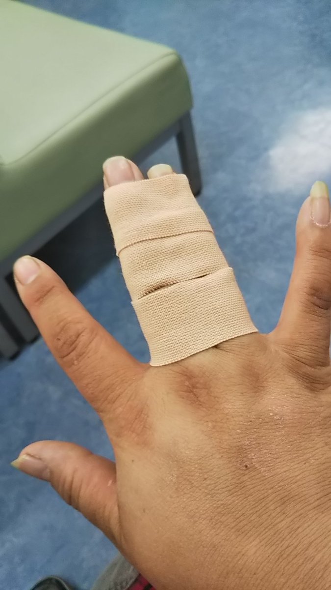 剥離骨折 剥離骨折