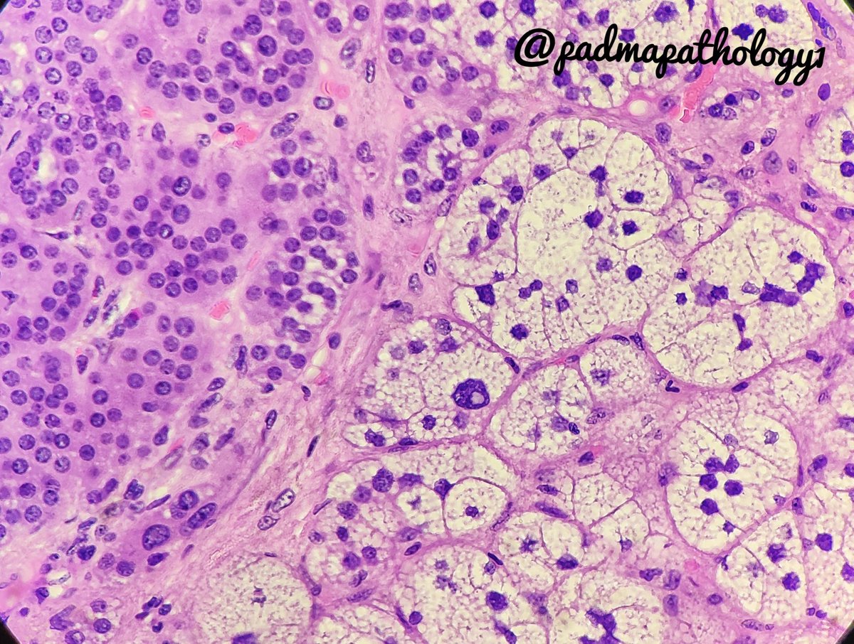 padmapathology1's tweet photo. Is this the #rightpower? #pathology #pathologists #EndoPath #TooEasyToDiagnose https://t.co/BAHznynwpI