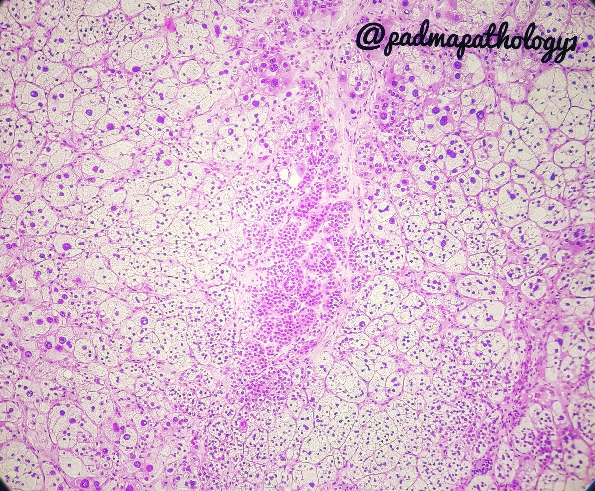 padmapathology1's tweet photo. Is this the #rightpower? #pathology #pathologists #EndoPath #TooEasyToDiagnose https://t.co/BAHznynwpI