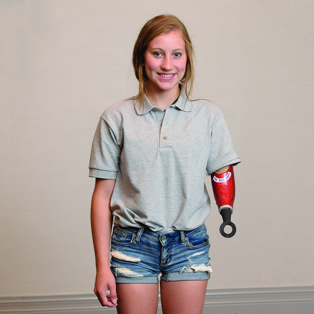 TheWarAmps's tweet image. Carly, whose amputation is at the elbow joint, loves curling with her new arm. Her curling broom goes through the spiral device at the end of her arm, which is made shorter than usual to give her more control. 🥌  #curlingday