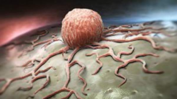 CancerNetwrk's tweet photo. ONCOLOGY sat down with @DrPatrickBorgen, from @MaimonidesMC, to discuss the latest trends in surgical and medical oncology, the transformation of breast cancer treatment over the course of his career, and the role he played within that evolution.

https://t.co/6kp4u4OIS6 https://t.co/8CHCPMWCJN