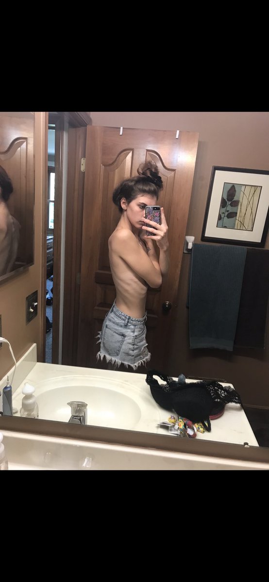 KenzieBull1's tweet image. #edawarenessweek I promise you, your weight does not define your worth. Recovery is the hardest thing I’ve ever gone through &amp;amp; am still going through but hopefully,one day, I will be able to accept myself in the skin I’m in, because I’m more than what numbers appear in the scale