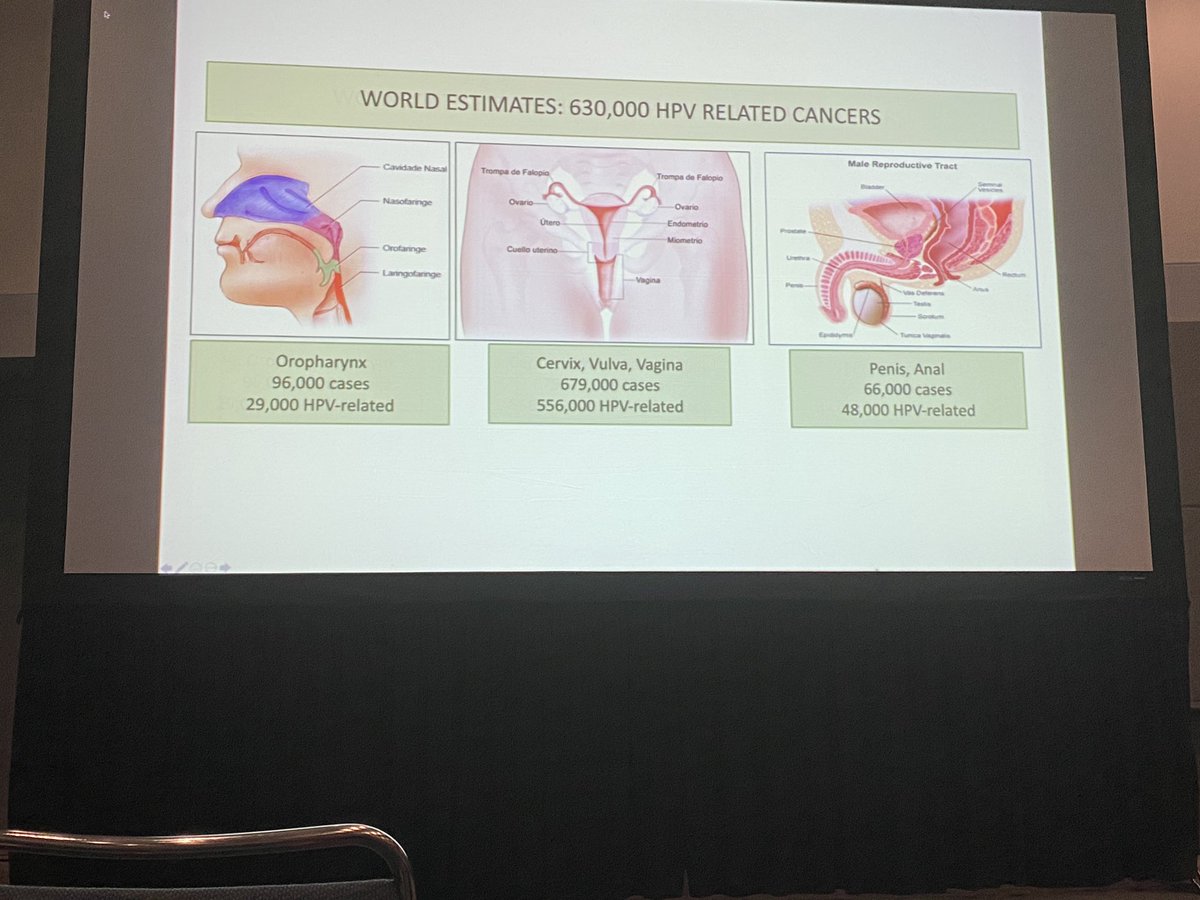 sam_albadri's tweet image. HPV related malignancies #HPVvaccine #cytopath @MayoClinicPath #USCAP2020 @TheUSCAP