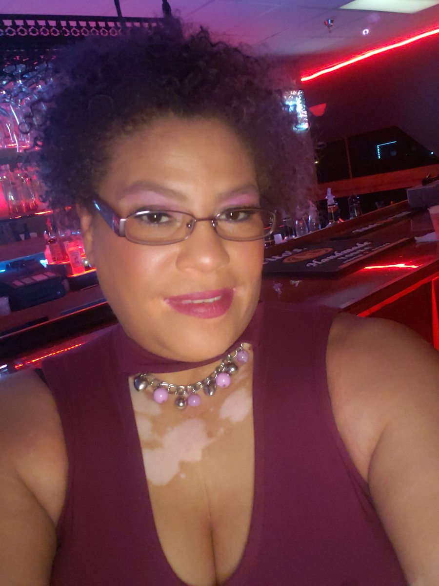 dapurplediva's tweet photo. @FaceEquality @GlamourMagUK #TeamVitiligo #MySkinCondition #VitiligoStrong #WillNotHideMyVitiligo only enhance my beauty #vitiligo4life https://t.co/m8AzbexGUH