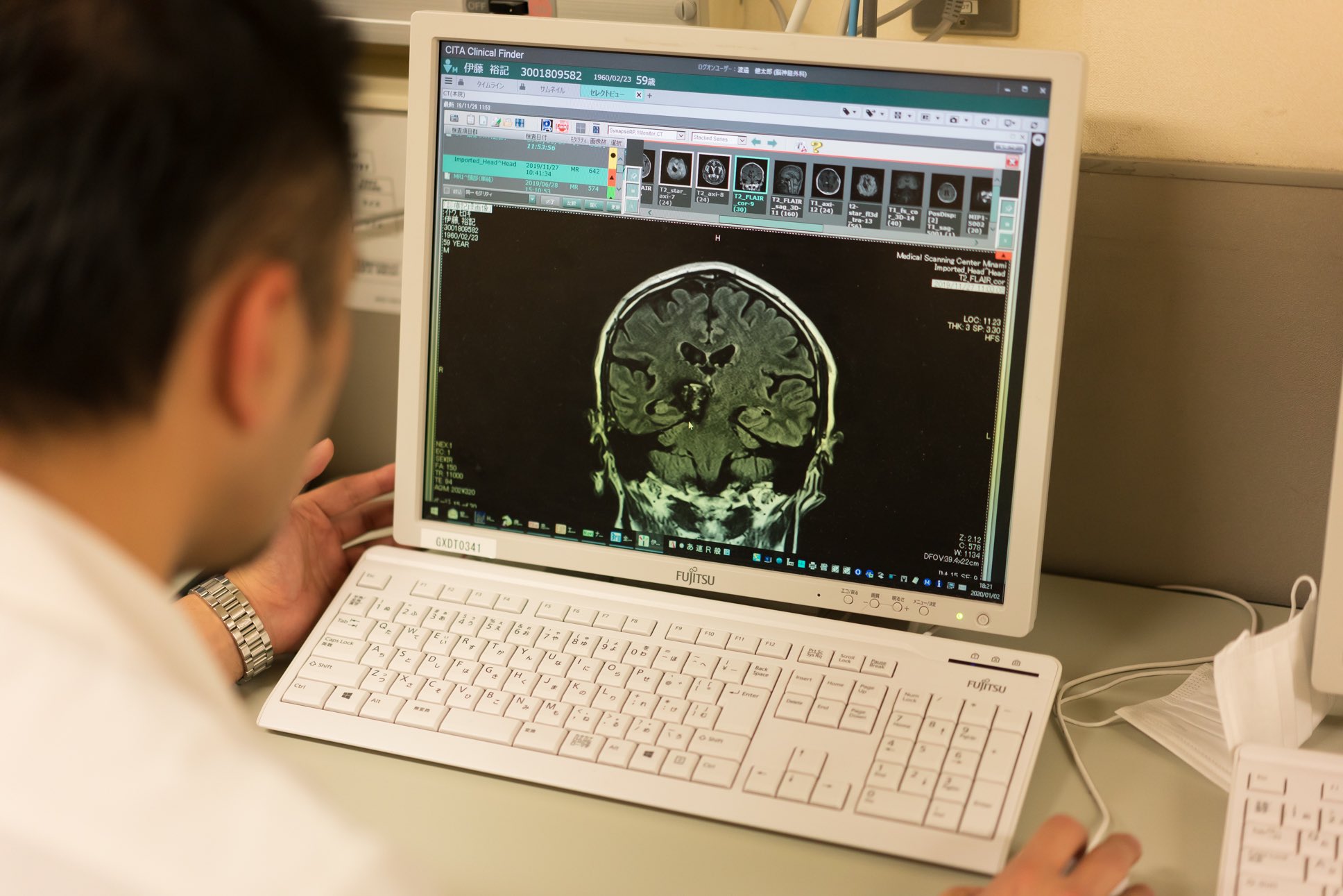 マイカン ヒロ 演出 海綿状血管種が頭の中心の深層部にありなかなか手術をしましょうと言ってくださる医師 がいなかったのですが東京慈恵会医科大学附属病院の脳外科渡邉健太郎医師が独自に開発した手術器具によって今回全摘出 出来ました 決して諦め