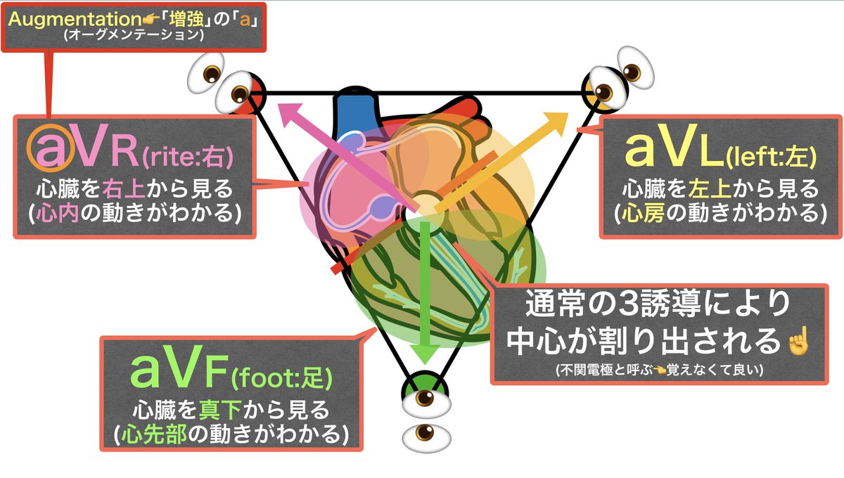 KuntaJo's tweet photo. 心電図は難しいけど

3誘導👉心臓の大まかな動き＆リズムを見ているだけ
（実際3誘導だとあまり細かいことまで分からない）

12誘導👉心臓をあらゆる方向(12方向)から見る。
（正確にどこが障害されているのか分かる）

12誘導は考えずに目で見て覚えるのがいいよ👍

ちょっと資料作ってみたから見て👀 https://t.co/fNIC7B3Pud