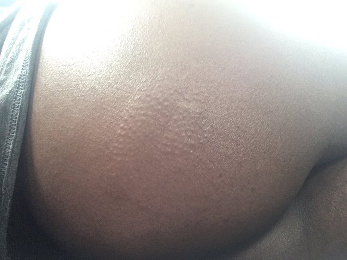 Got smacked soo hard on my ass with a cell phone, it left an impression... https://t.co/b9N357YeXk