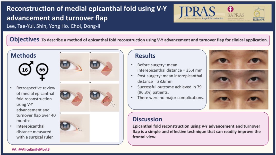 Jpras Augmenting The Epicanthic Fold This New Series Cases Increases The Length Of The Interepicanthal Distance 96 3 Good Results Plasticsurgery Eyelid Aesthetics Some4surgery T Co G2txileue6 T Co Zzraykovxs