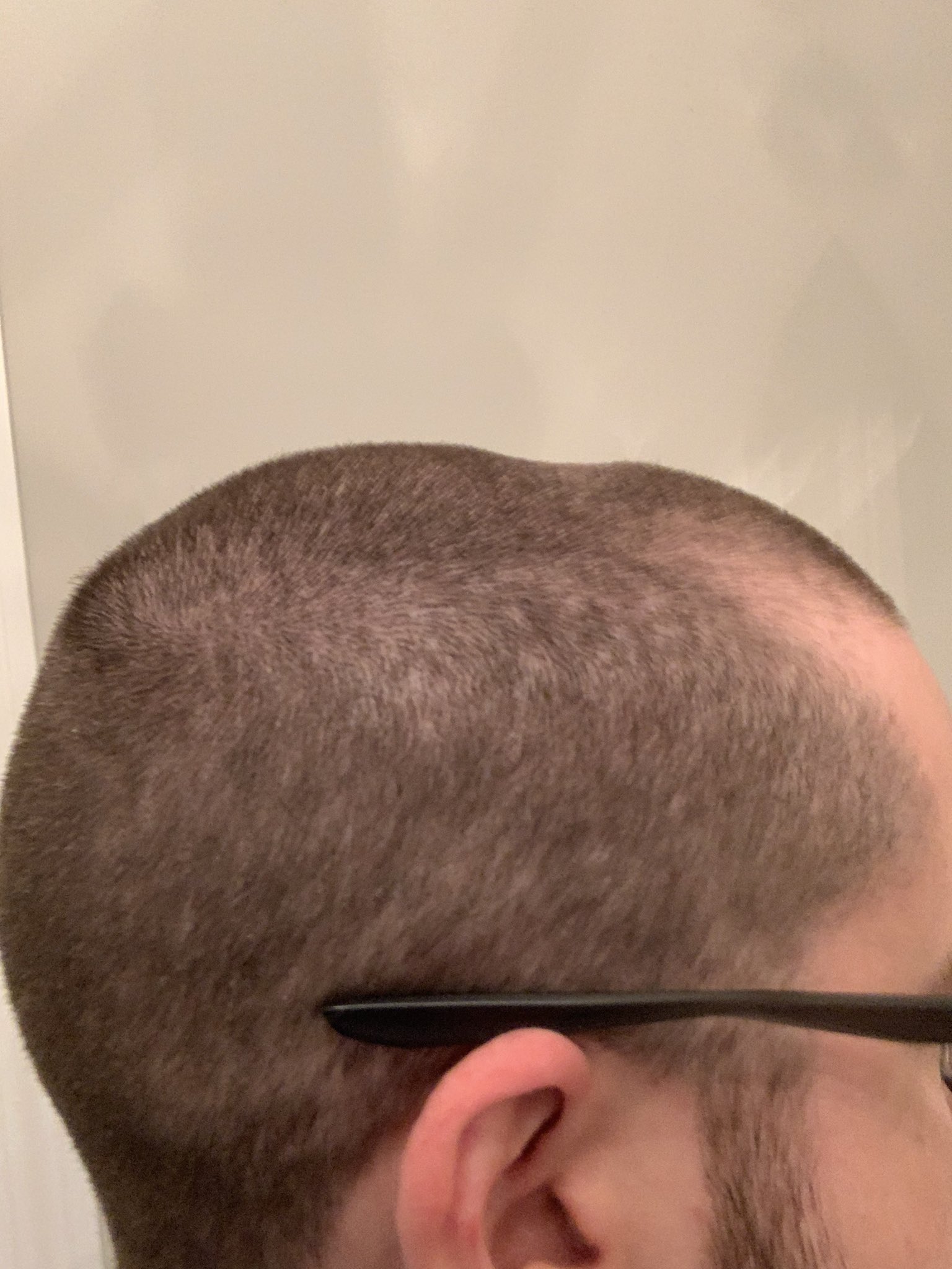 Cdew On Twitter The Headset Dent Is Too Real Also Pretty Sure I Gave My Self A Perma Bald Spot Shaving My Head This Time Around Gg Https T Co Cxdkvg8dul Twitter