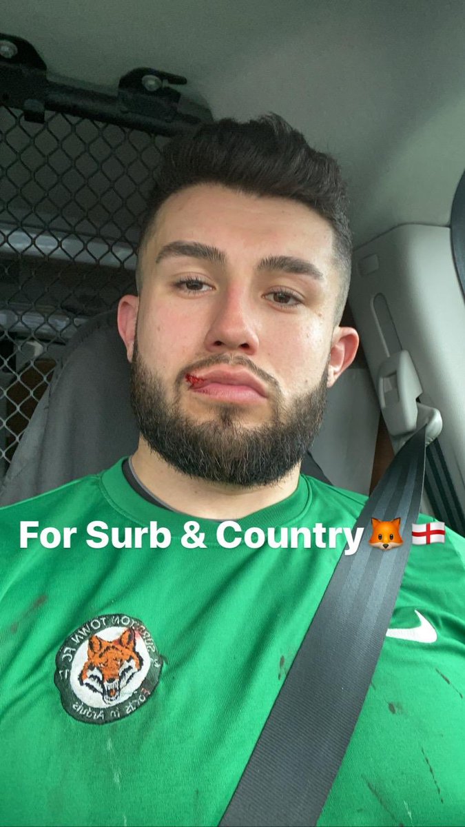 Lovely 3-1 win today away Vs Haydons Park including a tidy brace for @geero1996. Back on track. Only photo today features a bust lip for Clem, enjoy. #Surb #UpTheSurb