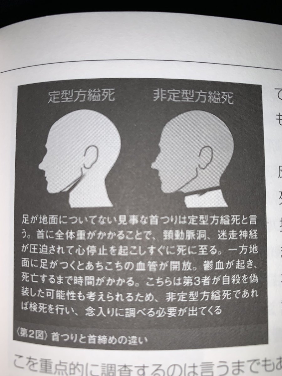 キャベン 因みに首吊りは自殺と他殺で跡が異なるらしい イラストのは