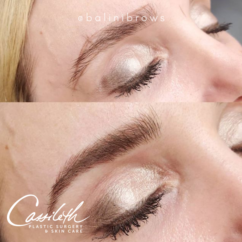 cassileth's tweet photo. 𝗗𝗥𝗘𝗔𝗠𝗬 𝗙𝗟𝗨𝗙𝗙𝗬 𝗕𝗥𝗢𝗪𝗦 by our brow specialist @balinibrows 
​ ​📧: frontdesk@cassileth.com ⁣⁣⁣⁣⁣⁣
☎️: 310-278-3200 ⁣⁣⁣⁣⁣⁣⁣⁣⁣ https://t.co/PmynGqLIDn