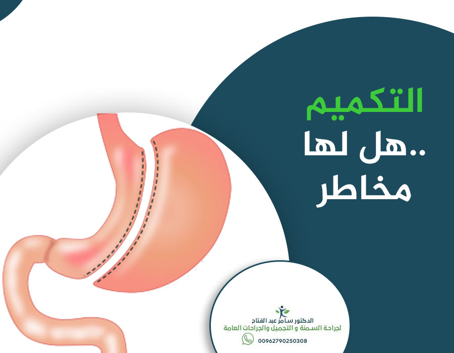 #مخاطر_عملية_التكميم..!؟
#قليلة #ونادرة للغاية، وتقتصر #مخاصر تكميم المعدة فقط في #التسريب ونسبته ضئيلة جدًّا تتراوح بين 1% إلى 3% فقط، وإذا مرّ #شهرين على العمليّة بدون #تسريب فهذه دلالة على عدم حدوثة.
لأي تفاصيل او استشارات تواصلوا مباشرة مع:
#الدكتور_سامر_عبدالفتاح
#تكميم