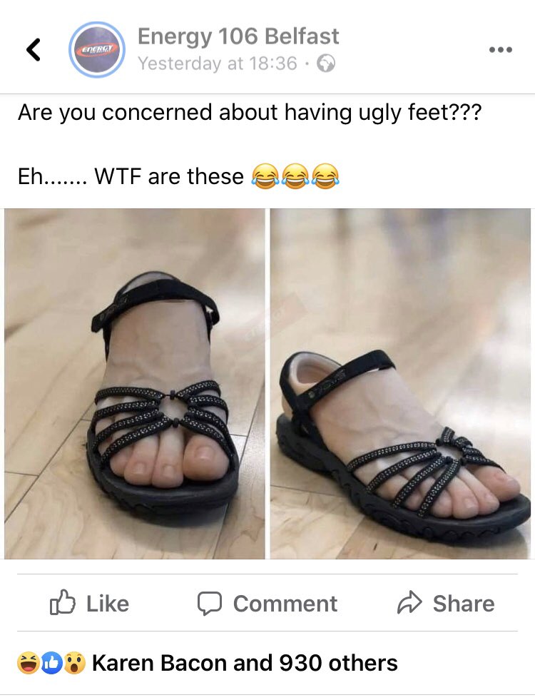 Mc28Lee's tweet image. Where can I get these for the summer 🤣🤣 #runnersfeet #runnersproblem #need 🦶