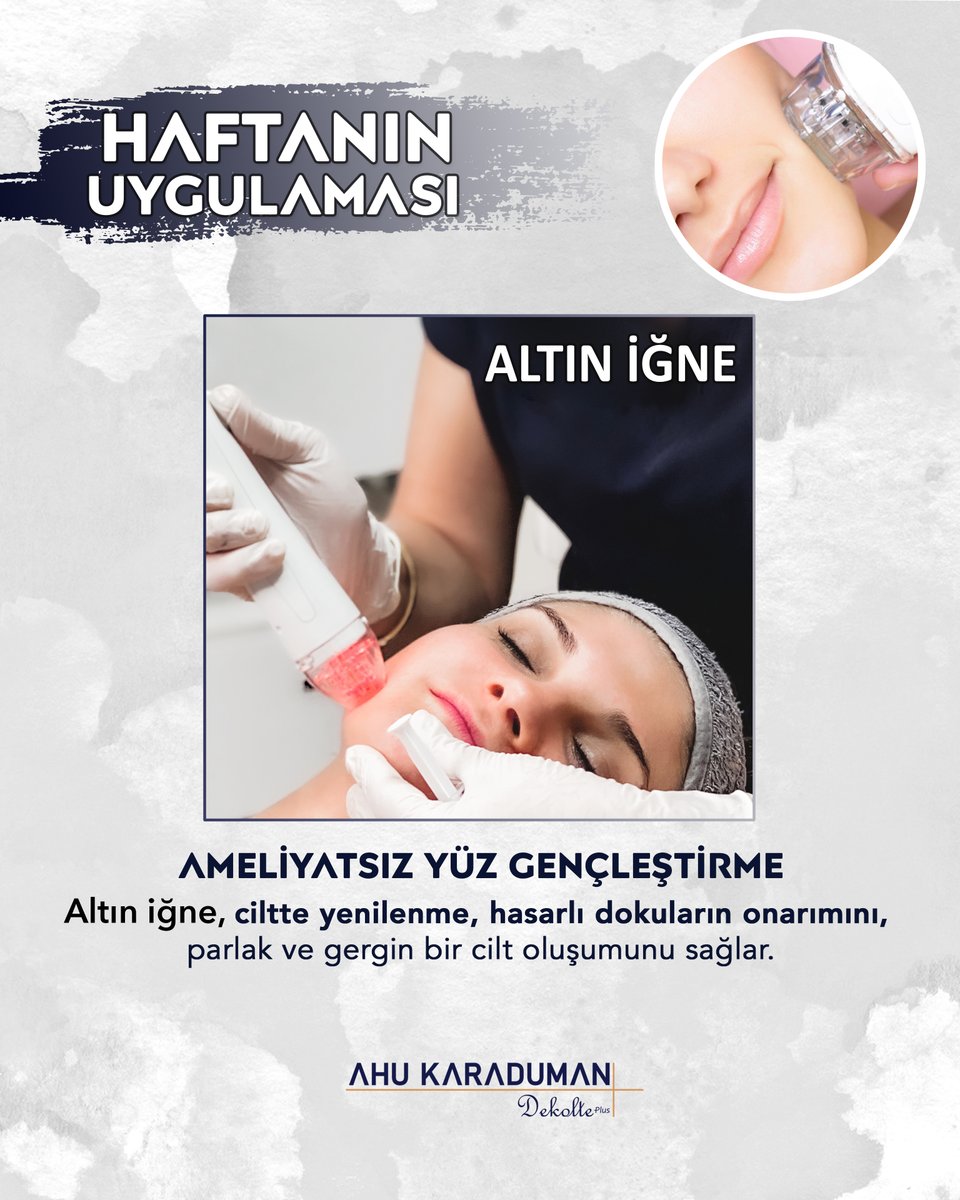 Haftanın En Popüler Uygulamasını Seçtik! 🤩
Altın İğne, Cilt Gençleştirme! 🌿
#altıniğne